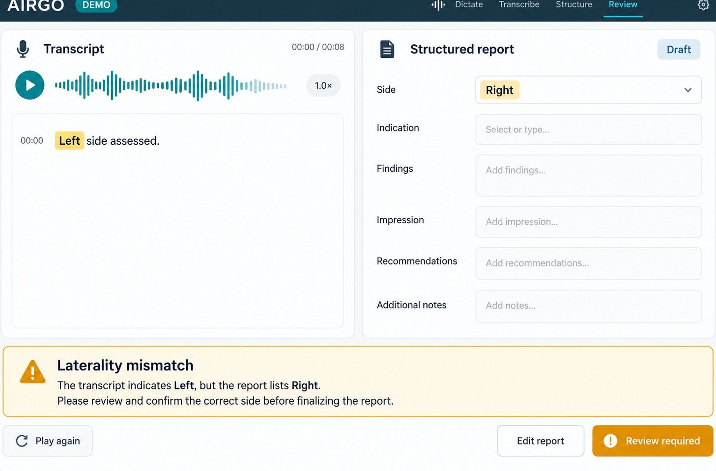 Dictation screen: transcript on the left, structured report fields on the right and a laterality-mismatch warning